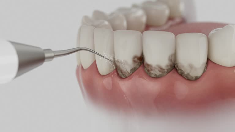 Trusted Teeth Cleaning And Checkup service in Montgomery, AL - Dentist Open Now